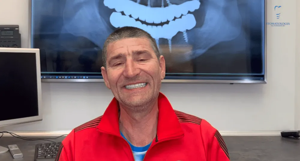 implanty-zebowe-poprawa-jakosci-zycia