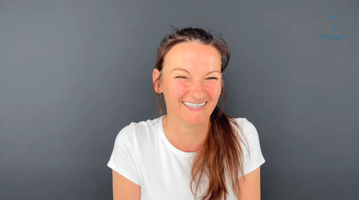 nowy-usmiech-po-implantach-zebowych