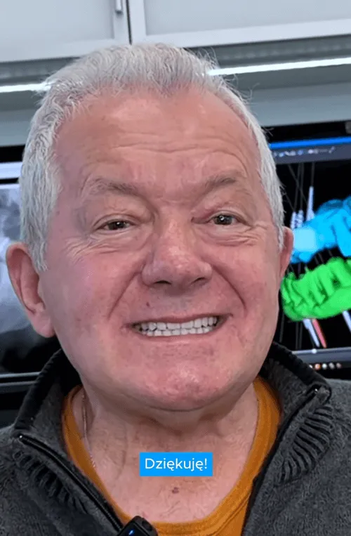 pacjent-po-leczeniu-all-on-4