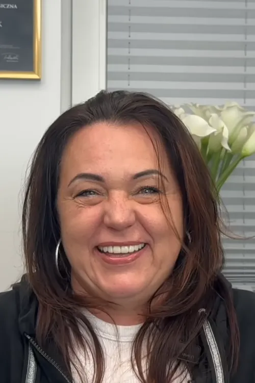 implantologia-szczecin-efekt-leczenia