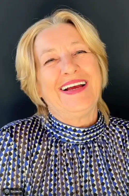 nowy-usmiech-po-all-on-4