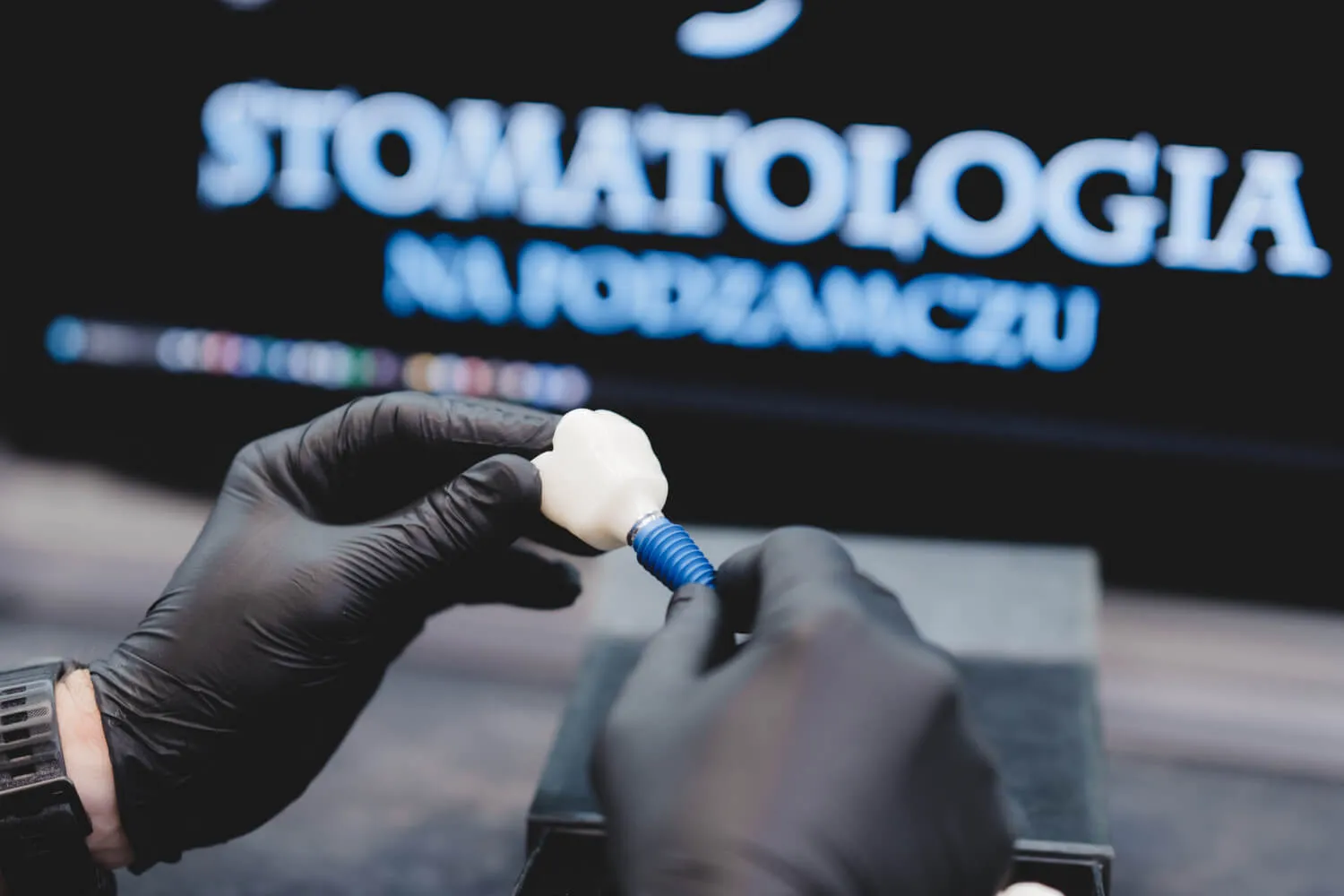 konsultacja-implantologiczna-szczecin