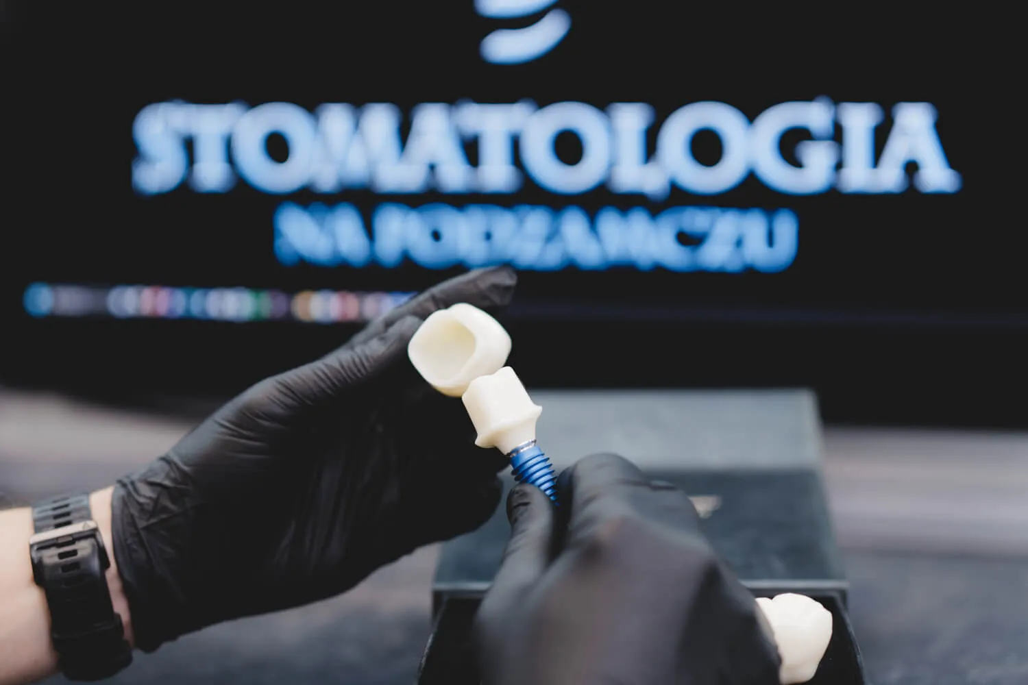 budowa-implantu-zeba