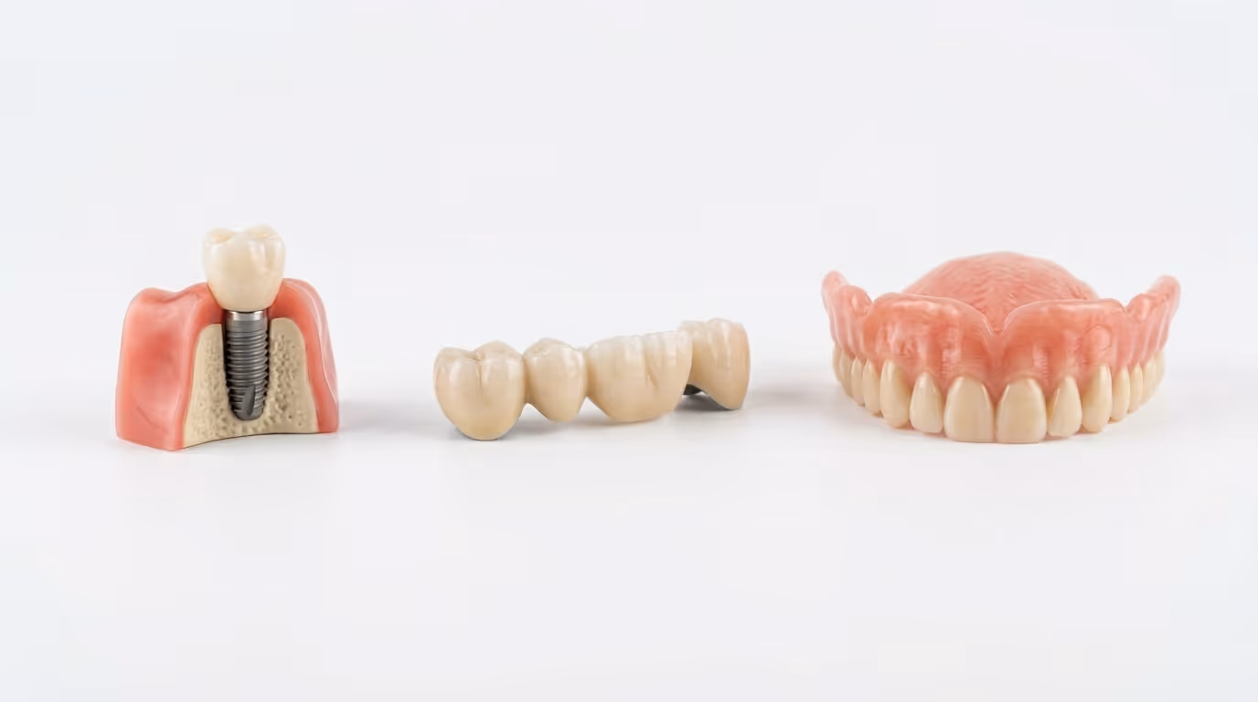 Trzy modele uzupełnień zębowych: implant z koroną, most protetyczny i proteza częściowa