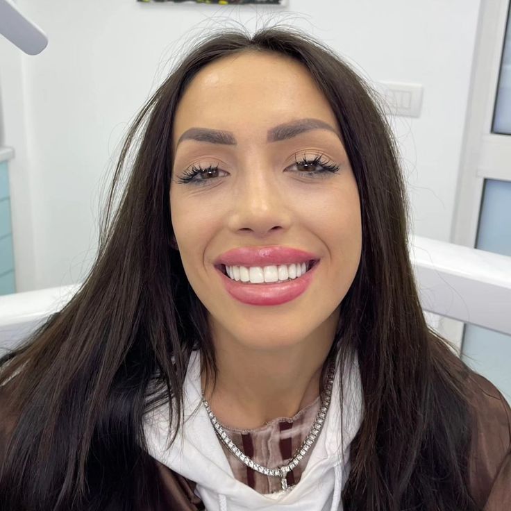 Patient smile result