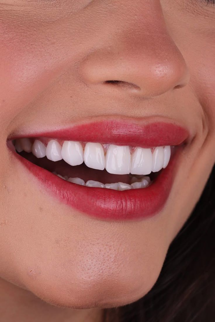 Dental Bridge article