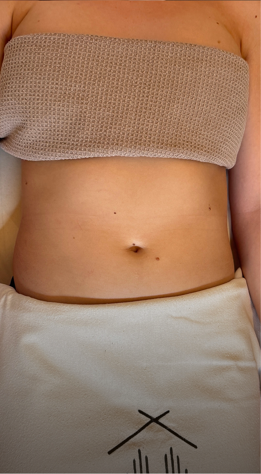 Lymphatic Duo – Bauch vor der Behandlung