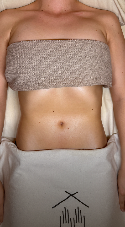 Lymphatic Duo – Bauch nach der Behandlung