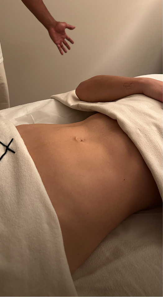 Brasilianische Lymphdrainage – Bauch vor der Behandlung, Seitenansicht