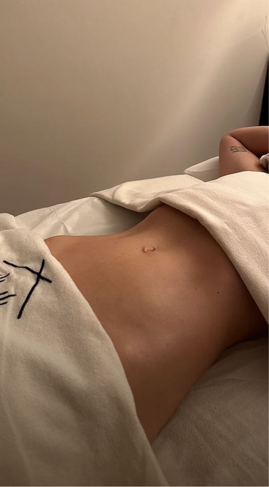 Brasilianische Lymphdrainage – Bauch nach der Behandlung, Seitenansicht