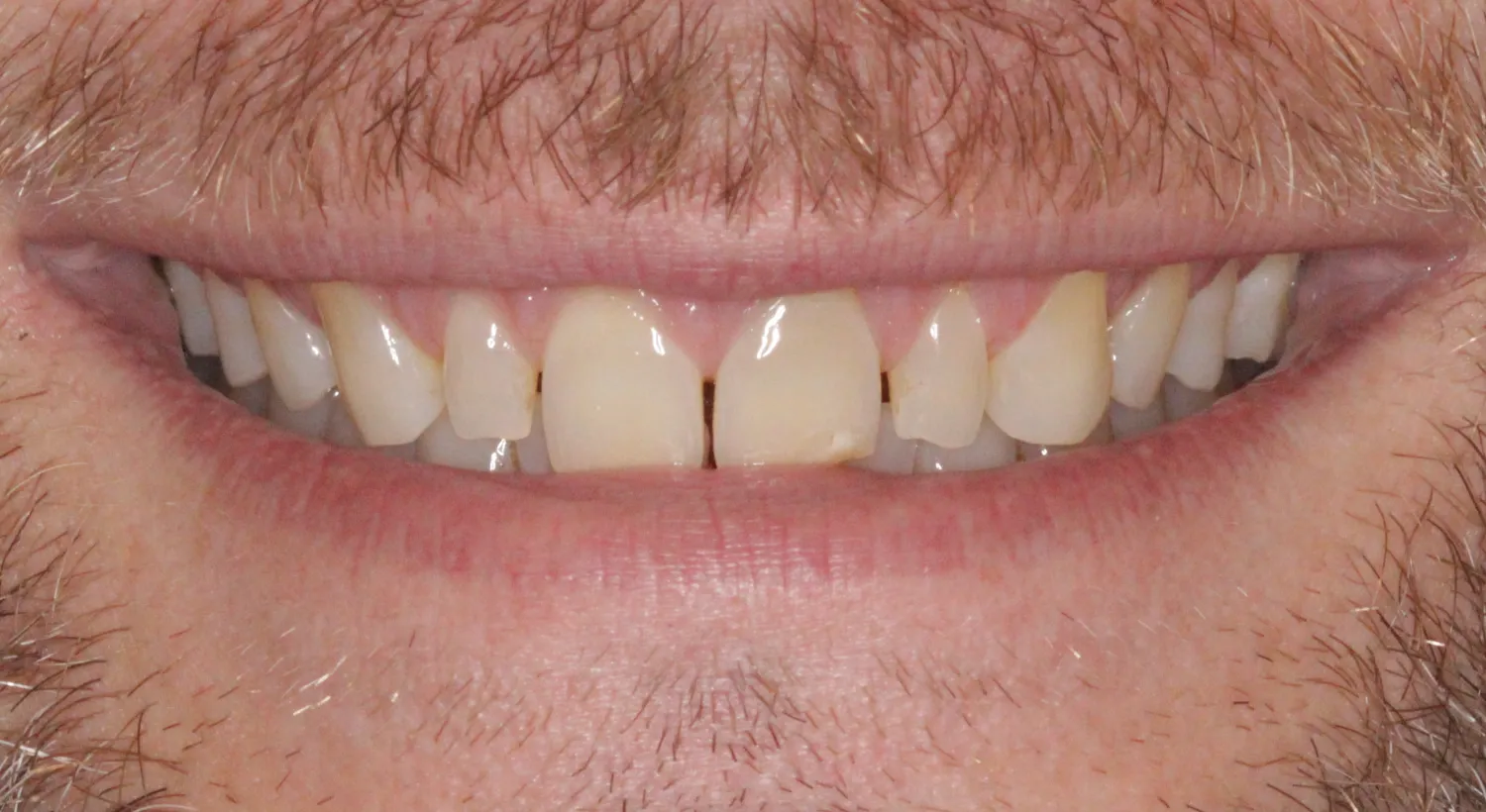 Before Image