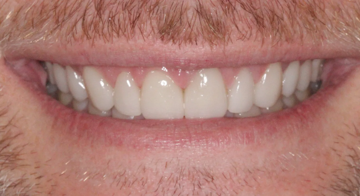 After Image
