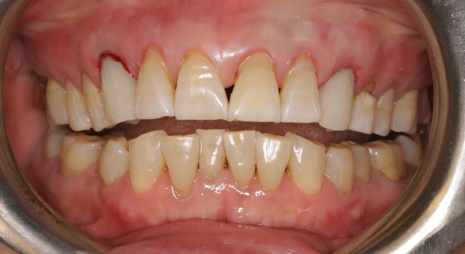 Before Image
