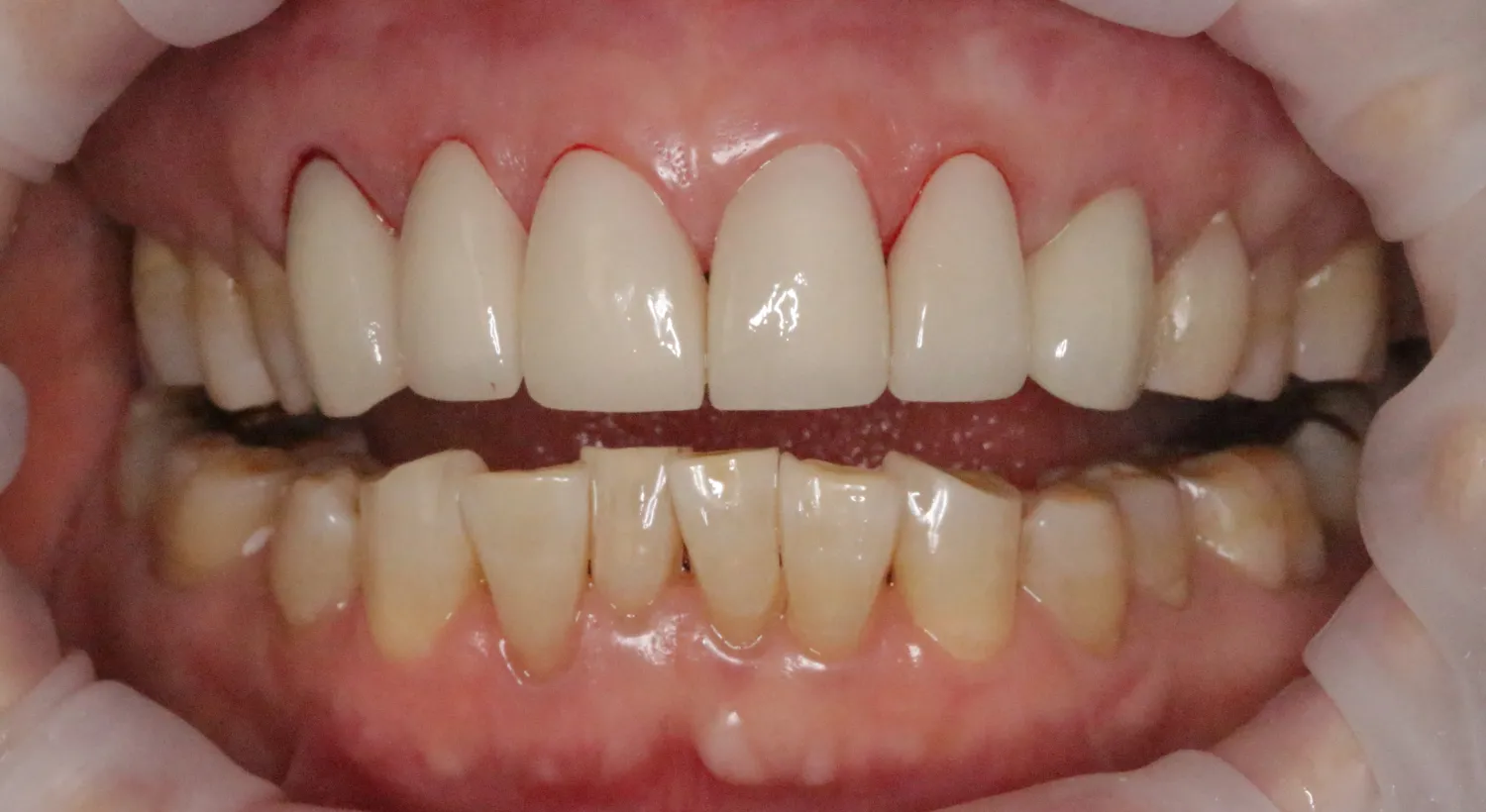 After Image