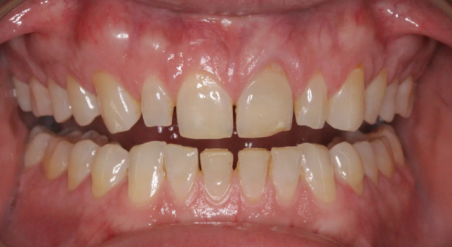 Before Image