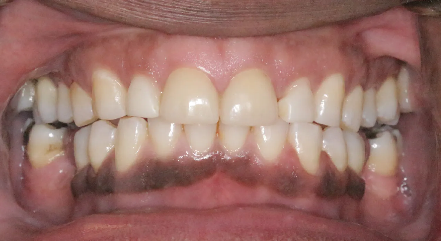 Before Image