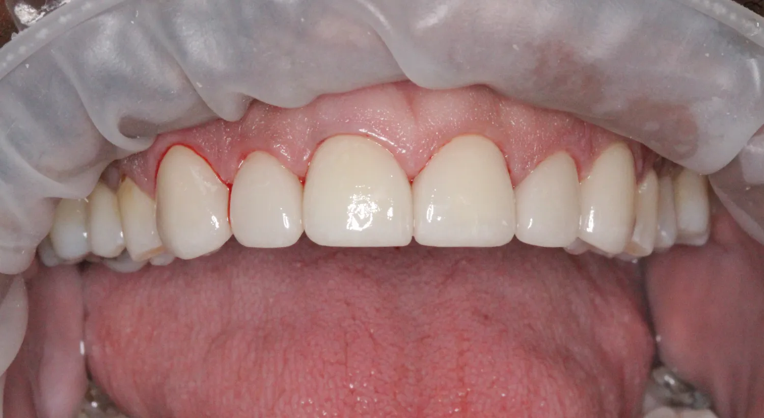 After Image