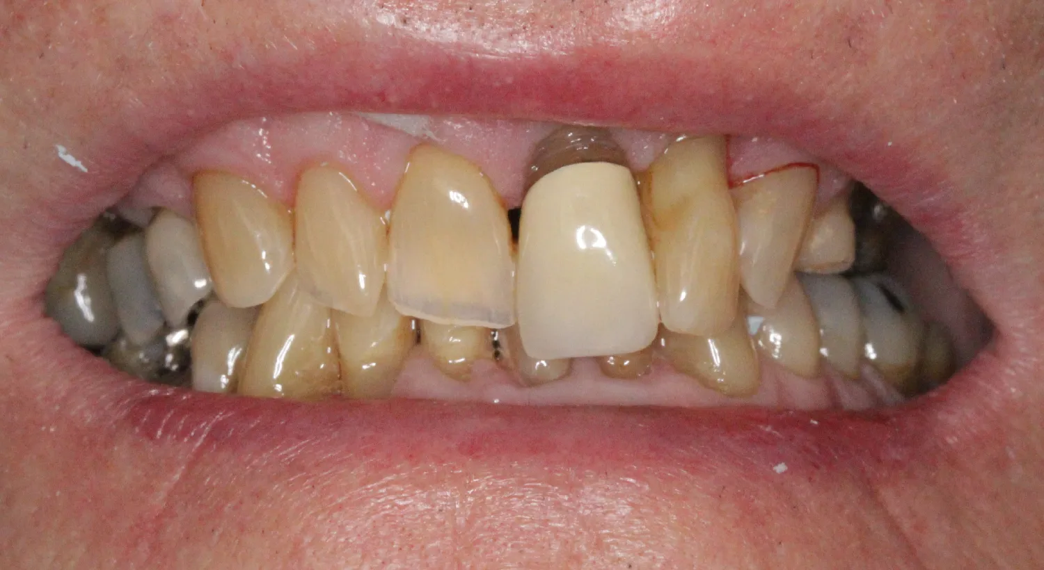 Before Image