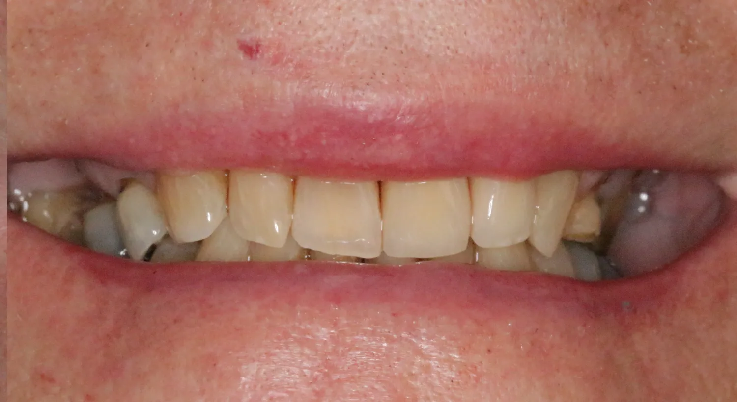 After Image