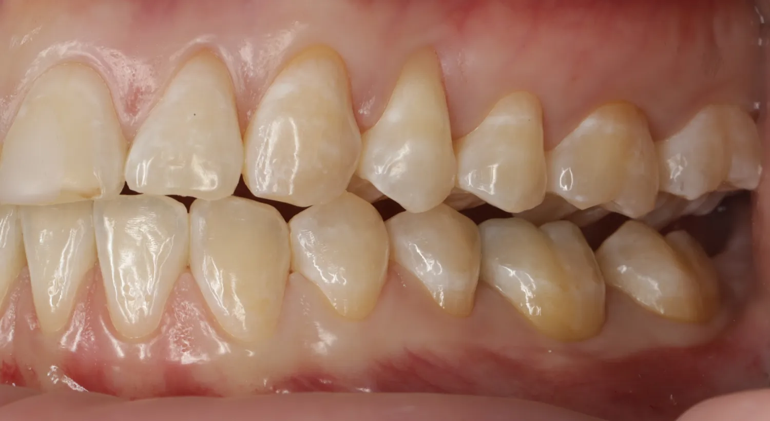 Before Image