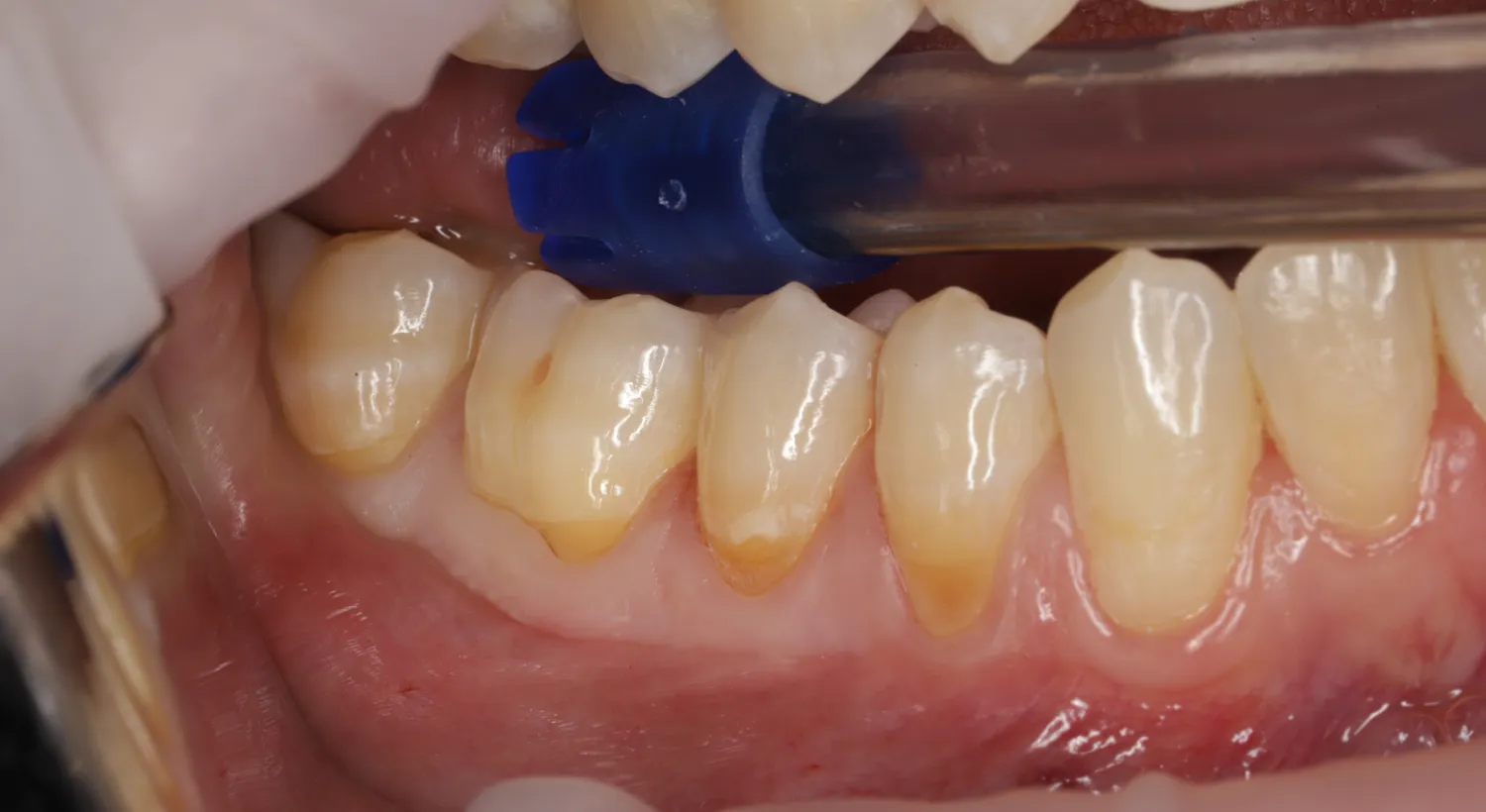 Before Image