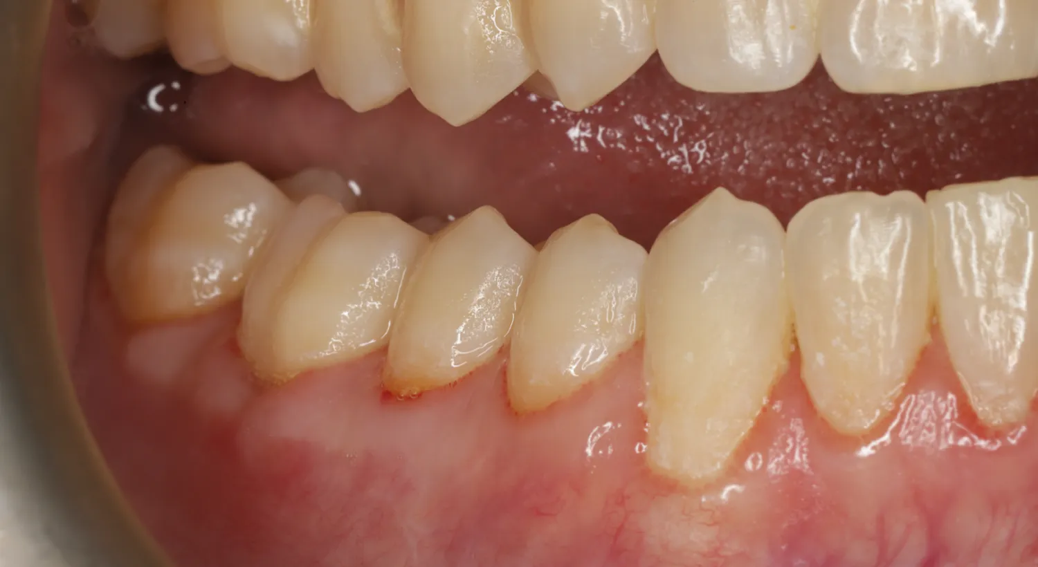 After Image