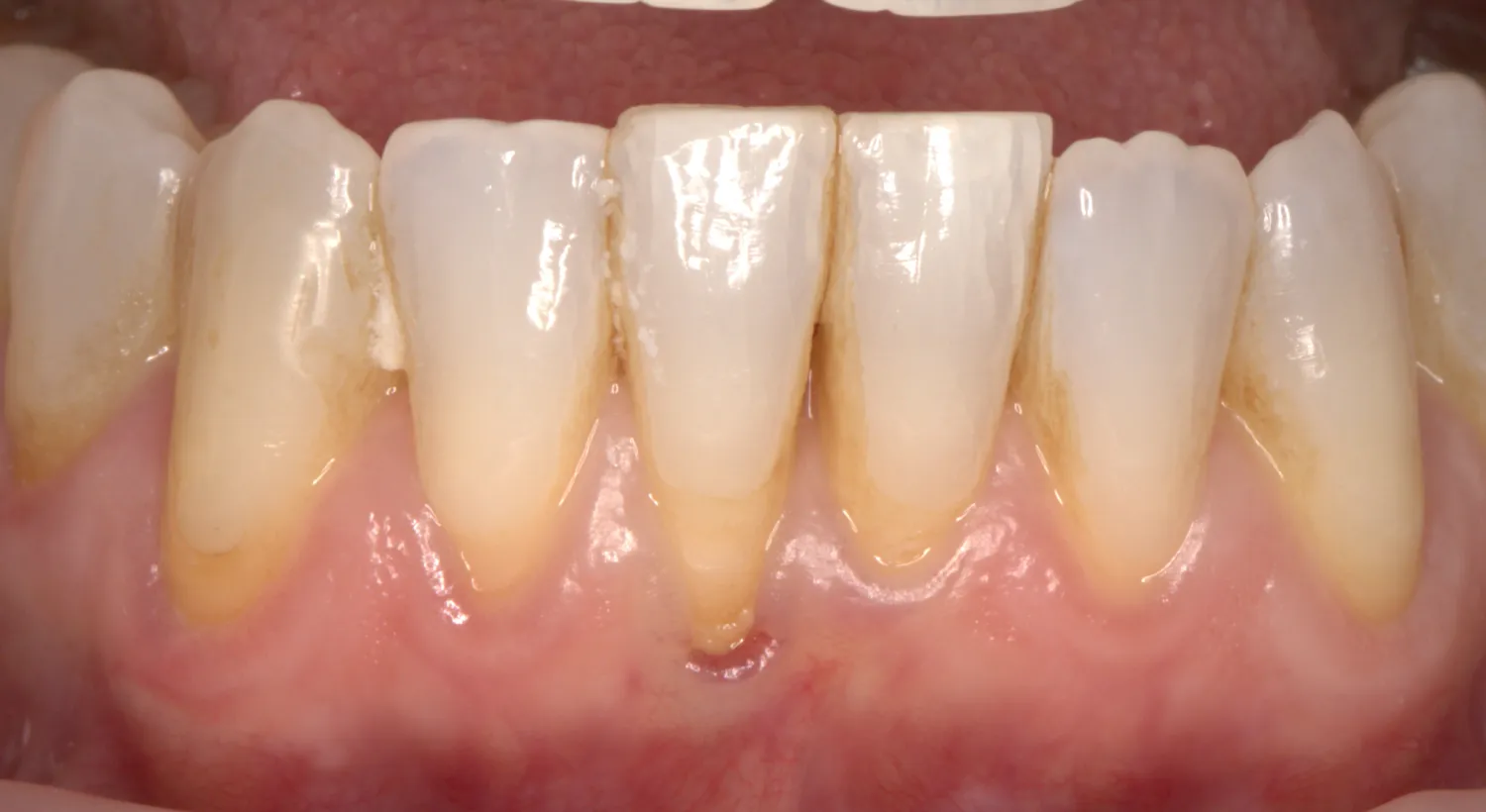 Before Image