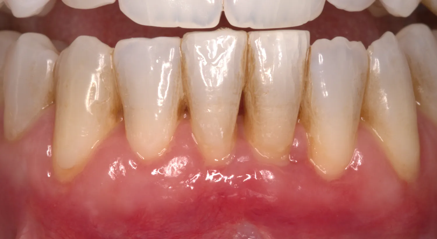 After Image