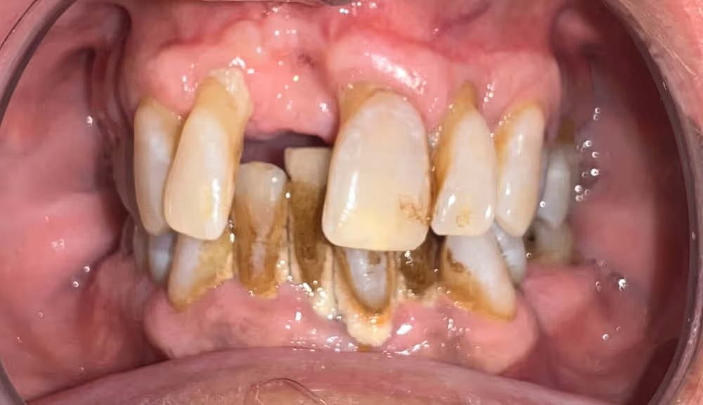 Before Image