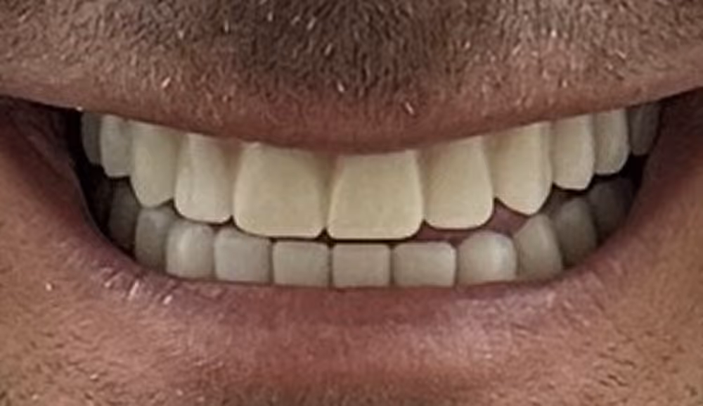 After Image