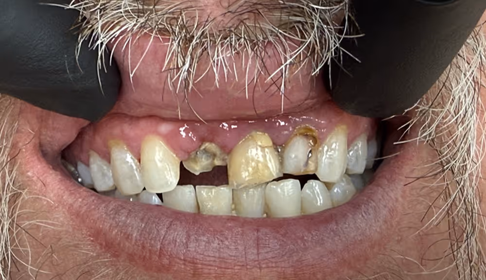 Before Image