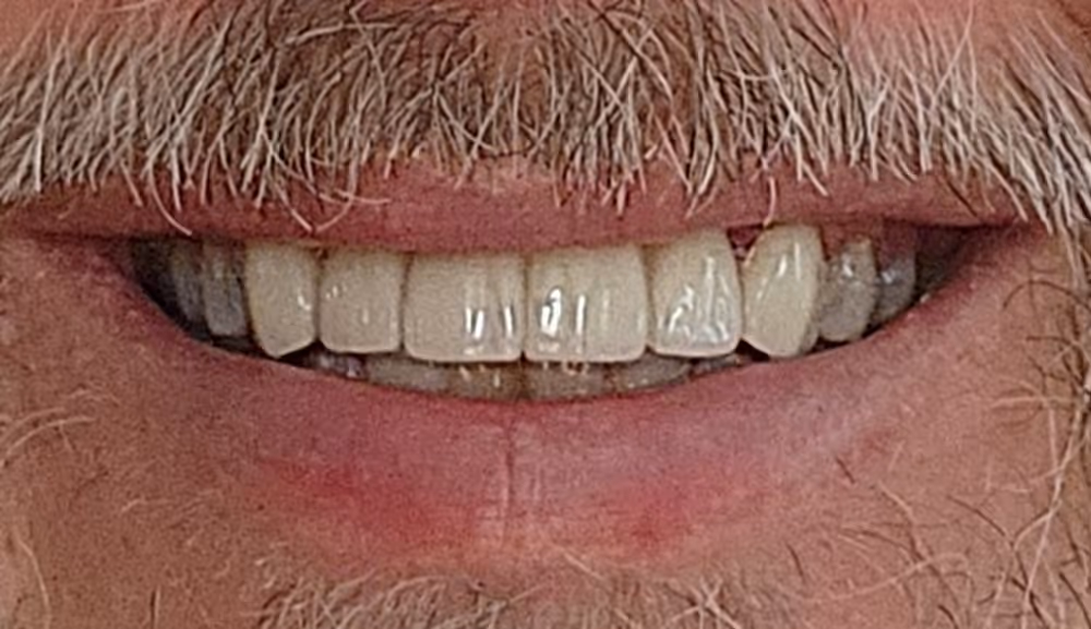 After Image