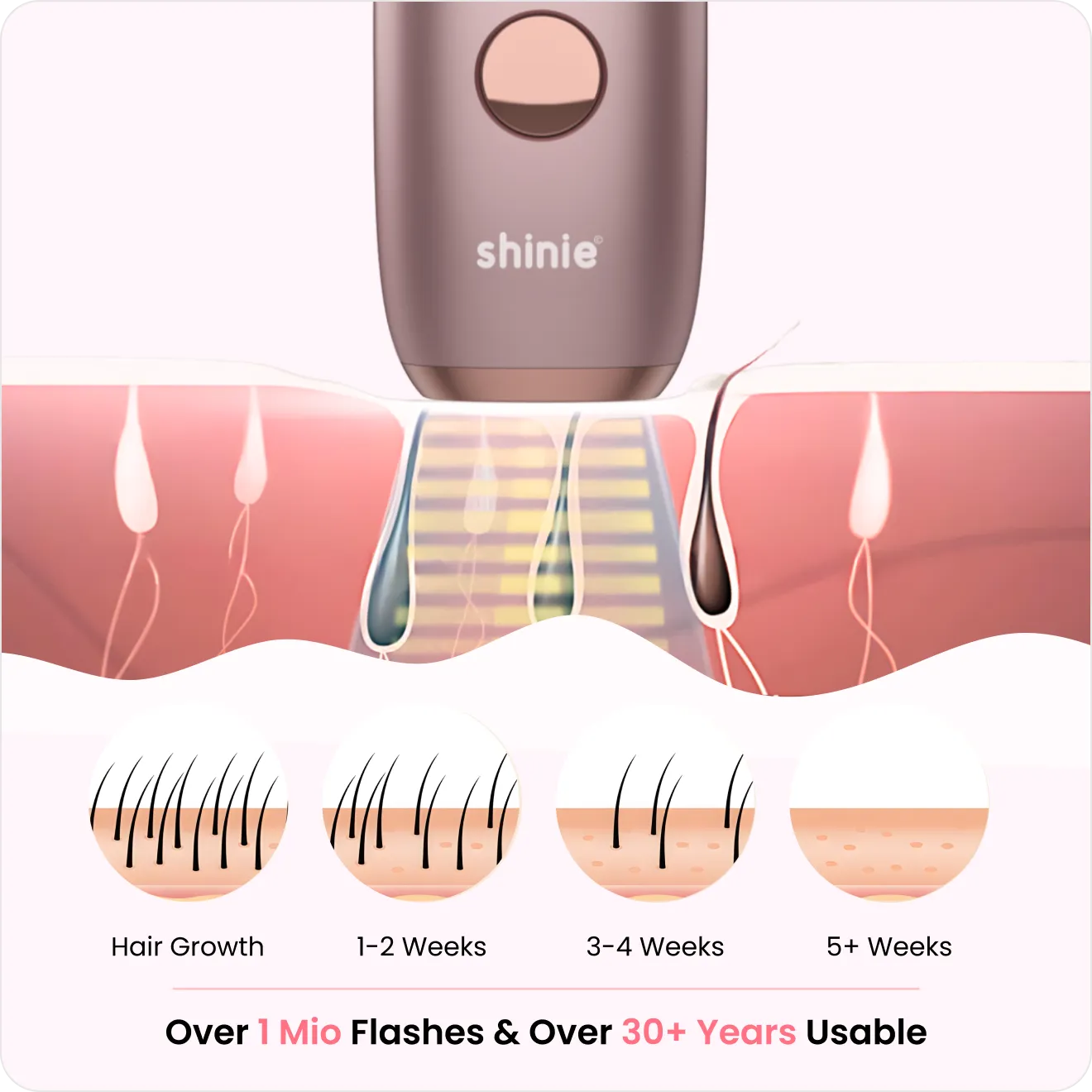 Illustration of laser hair removal device on skin showing hair growth stages from 1-2 weeks to 5+ weeks.
