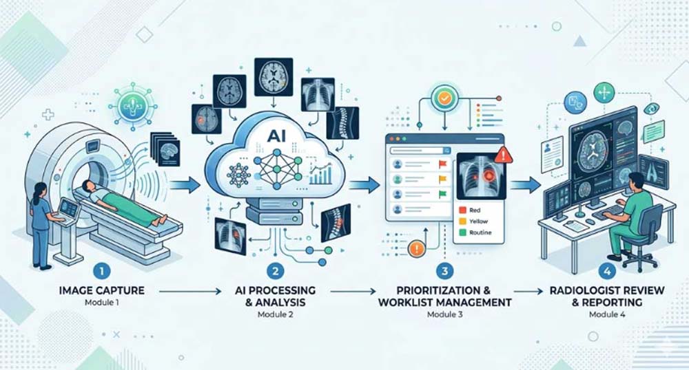 AI-assisted medical imaging workflow showing triage and prioritization in hospitals
