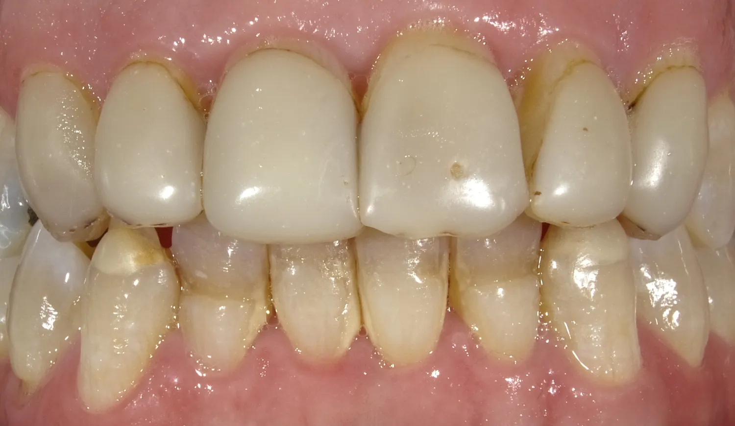 Before Image