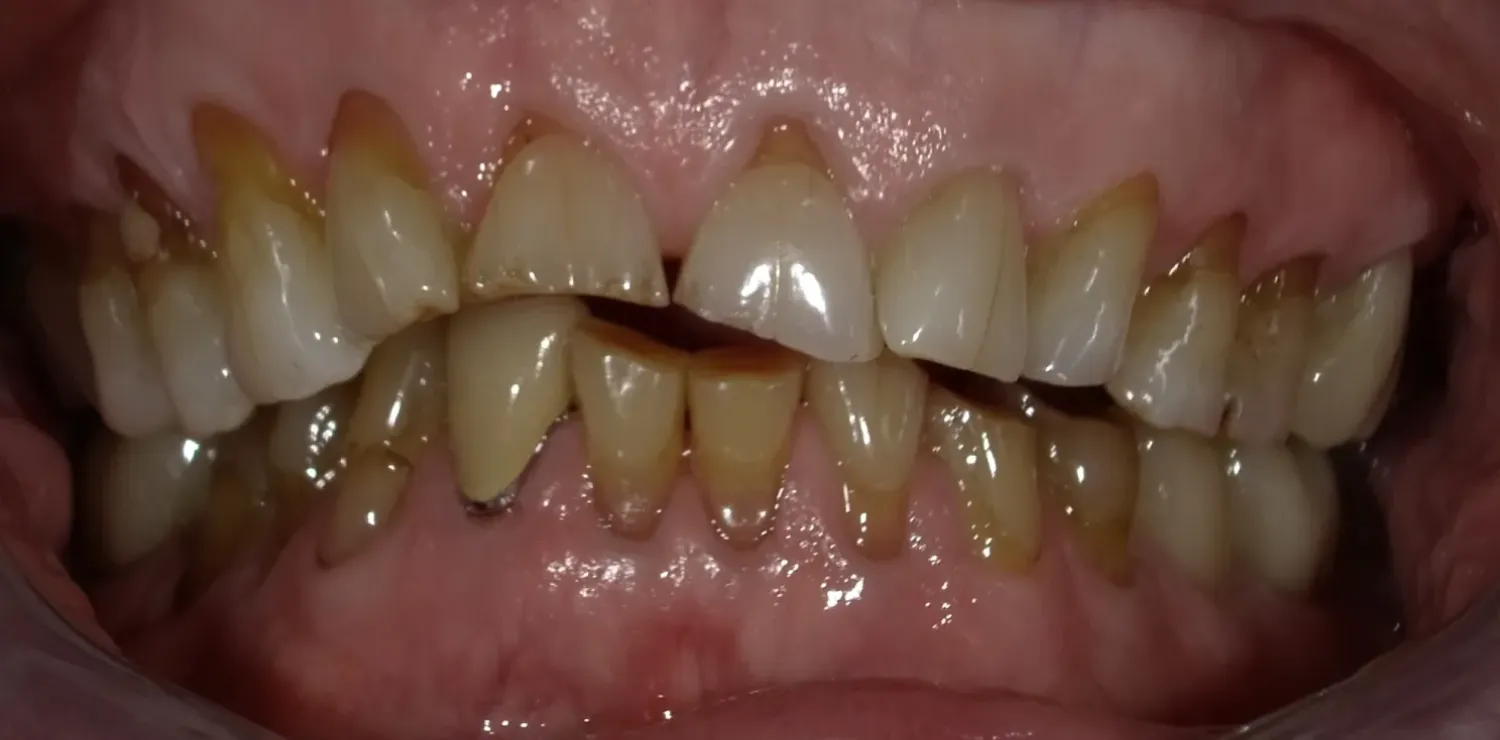 Before Image