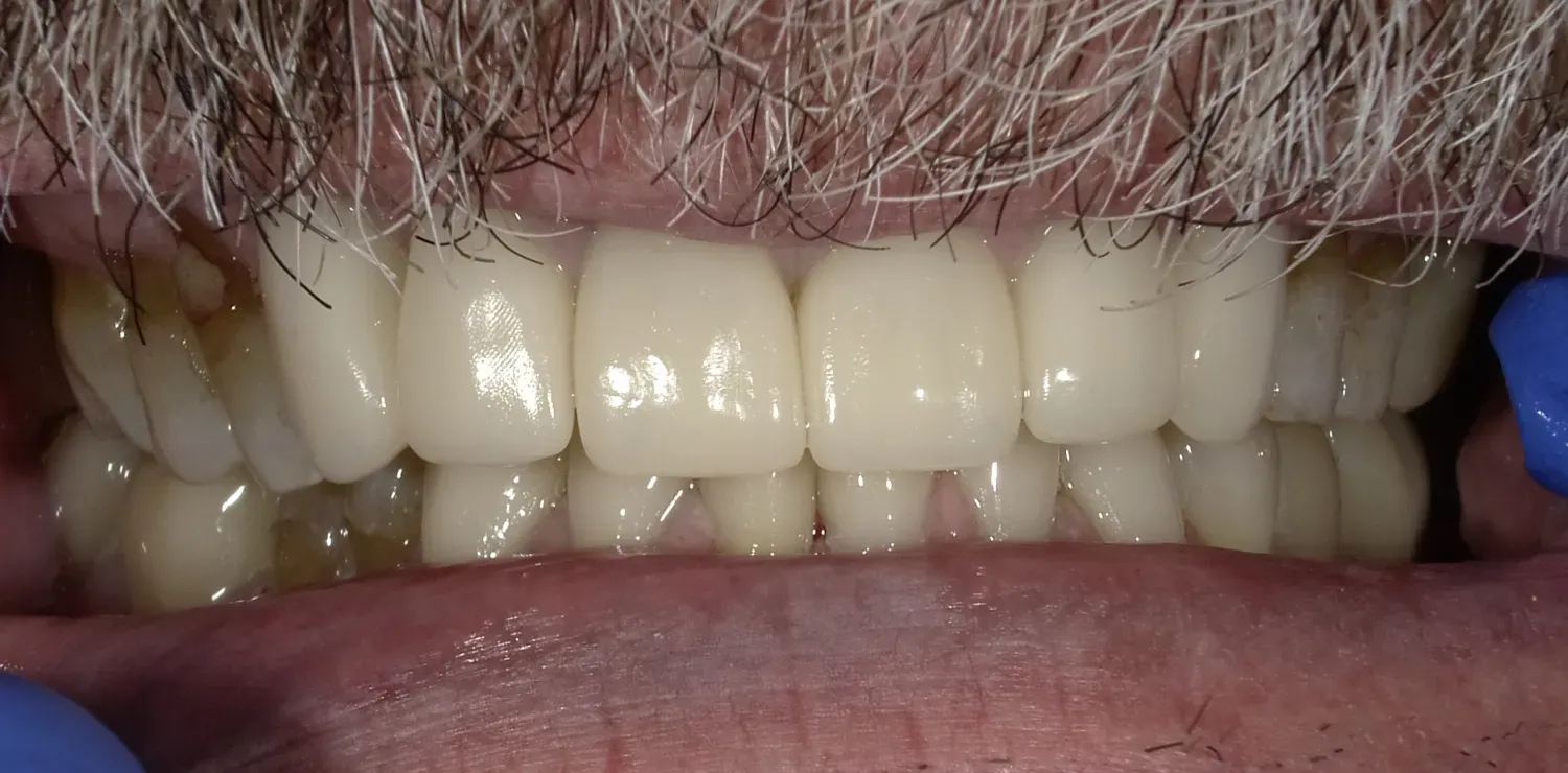 After Image