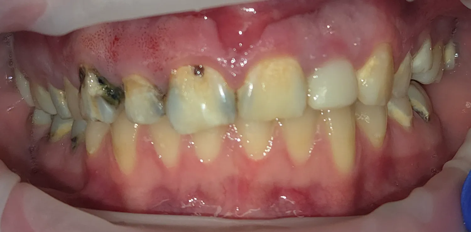Before Image