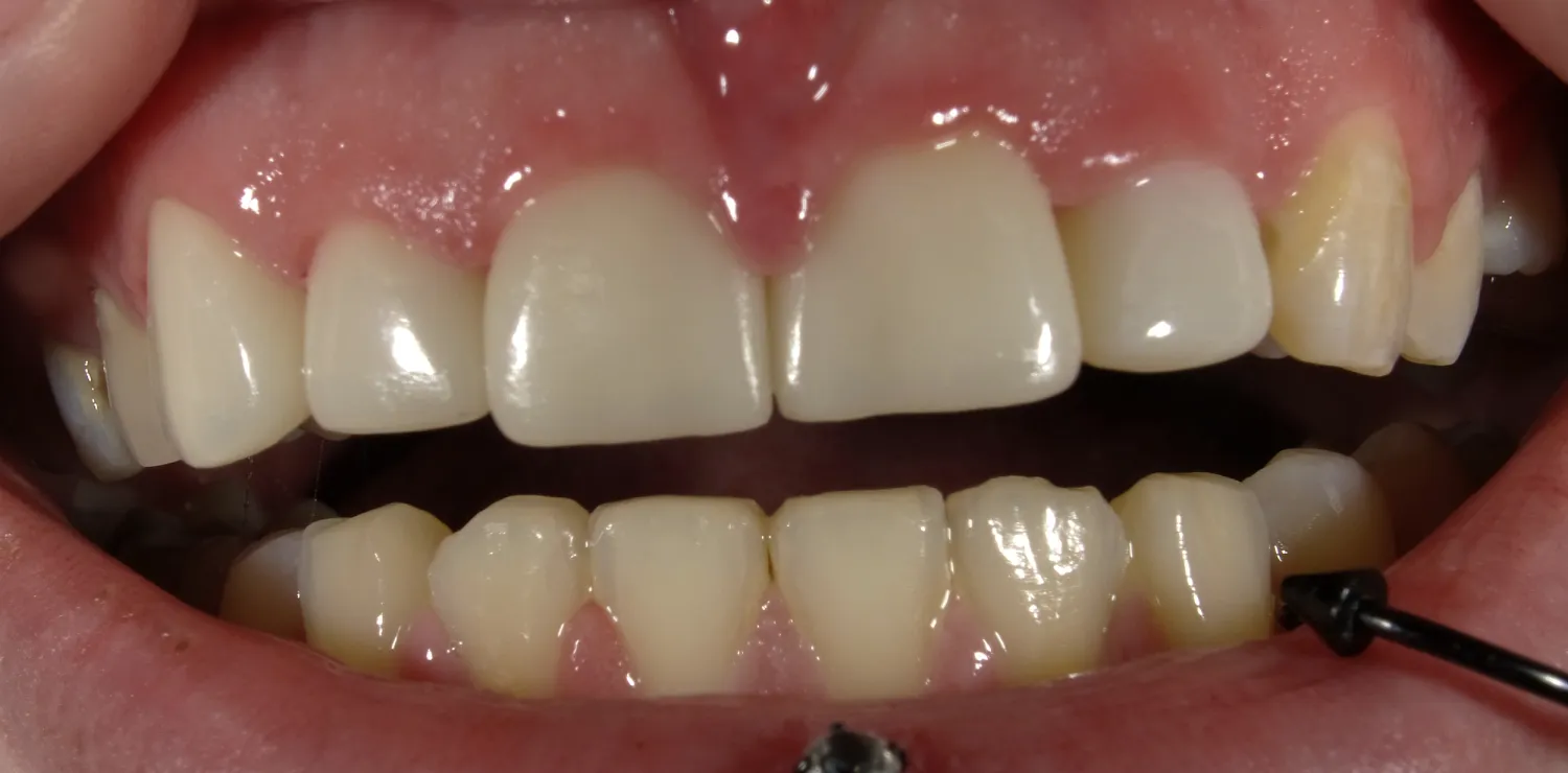 After Image