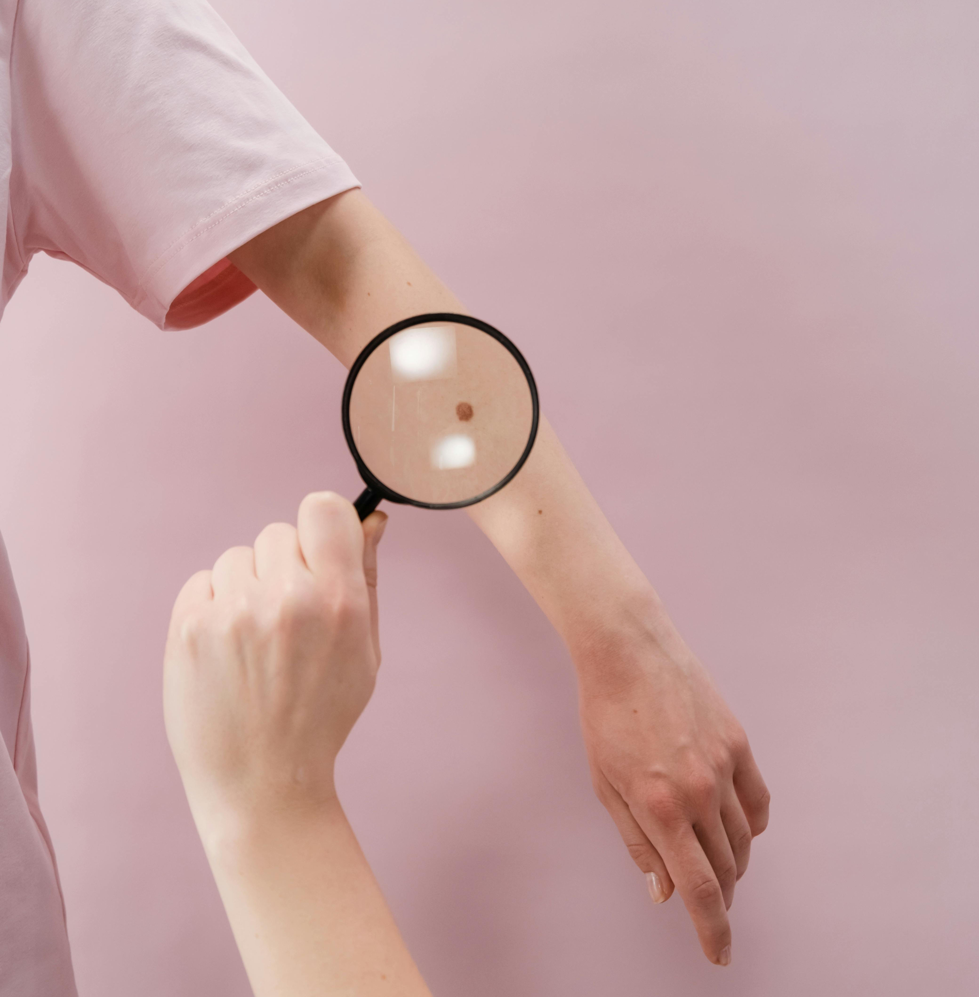 powiększenie lupa pieprzyka na przedramieniu