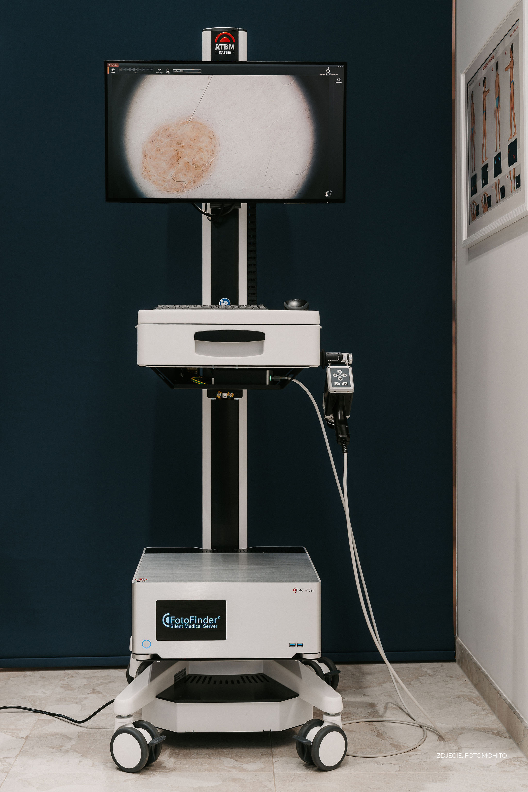 DermedeaClinic_wideodermatoskopia
