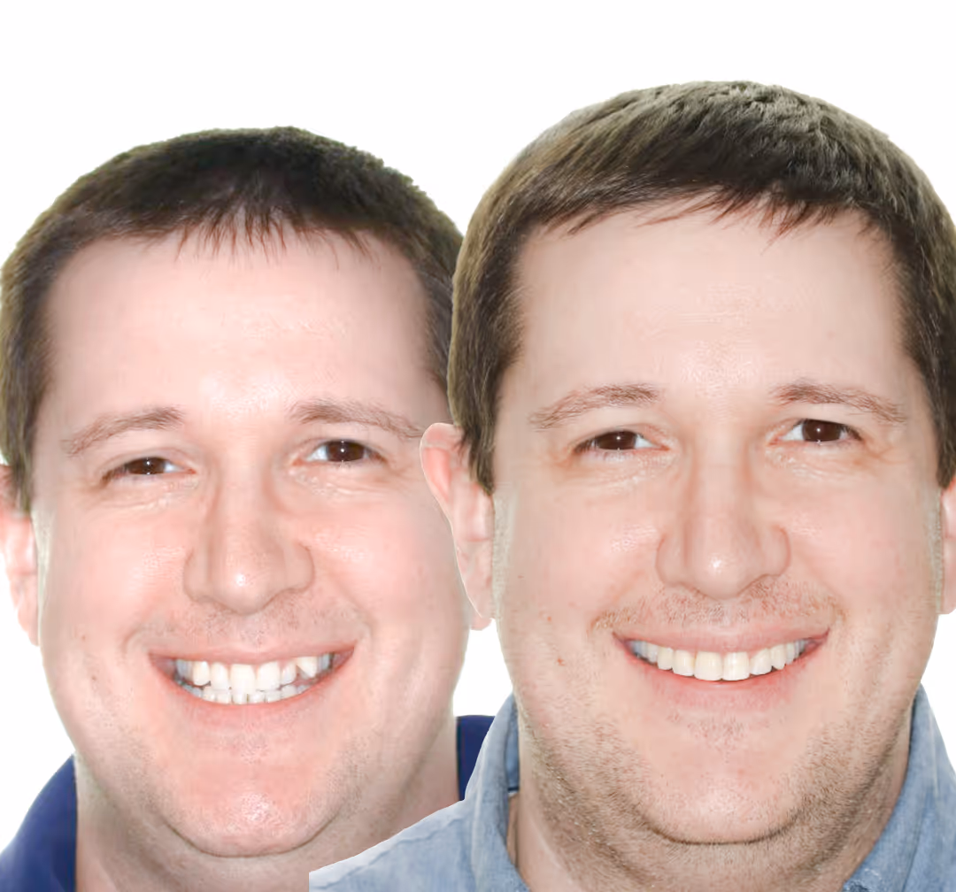 Impossible to possible