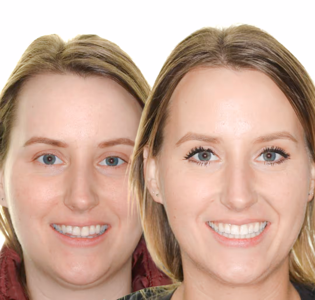 Confidence Recharged