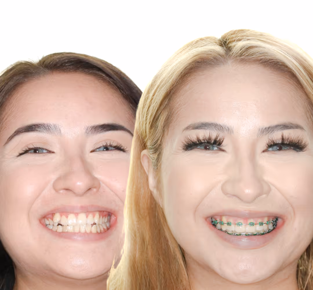 A Smile Refined with Purpose