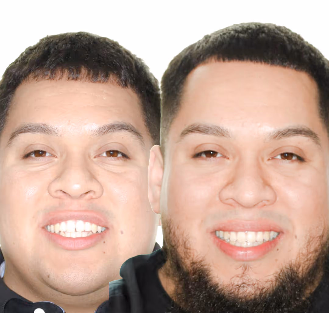 Smile Arc Defined: Discovering Value Through Understanding