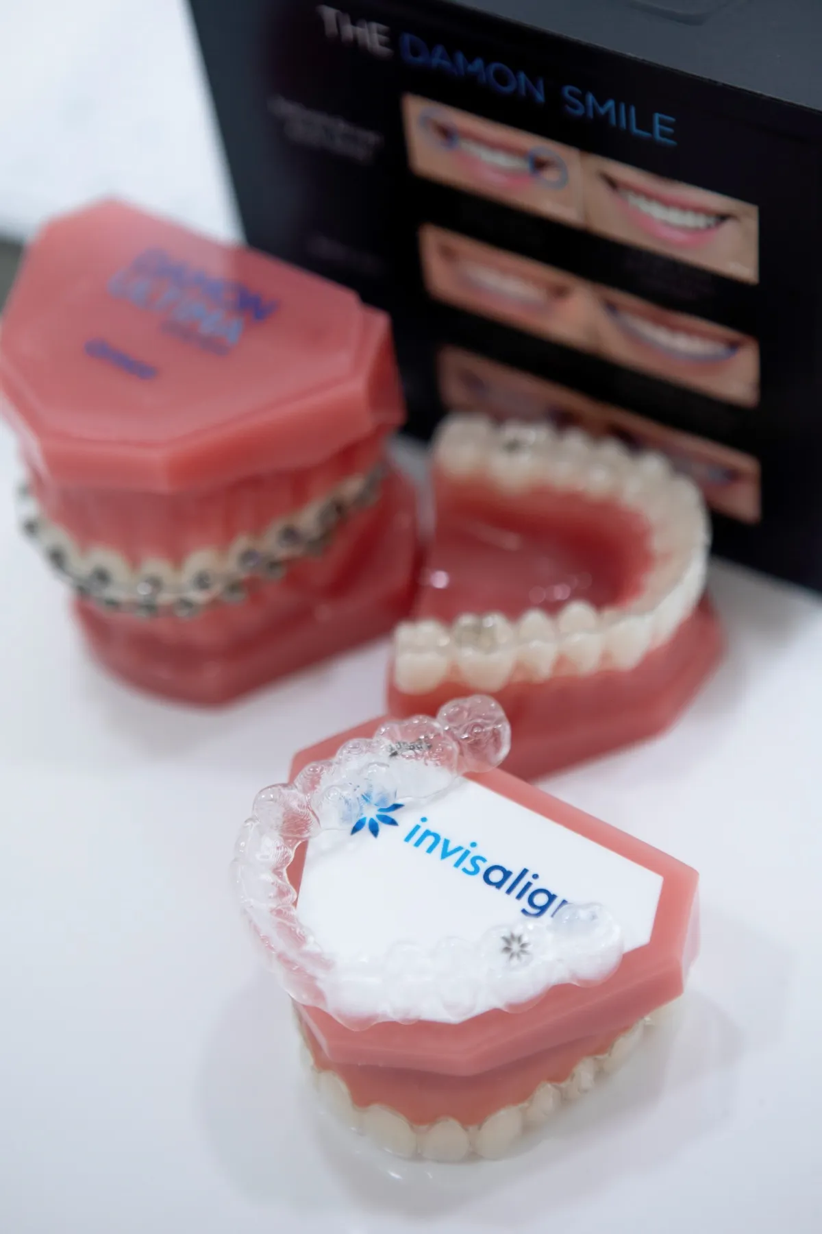 Dental models displaying traditional braces and a clear Invisalign aligner tray.