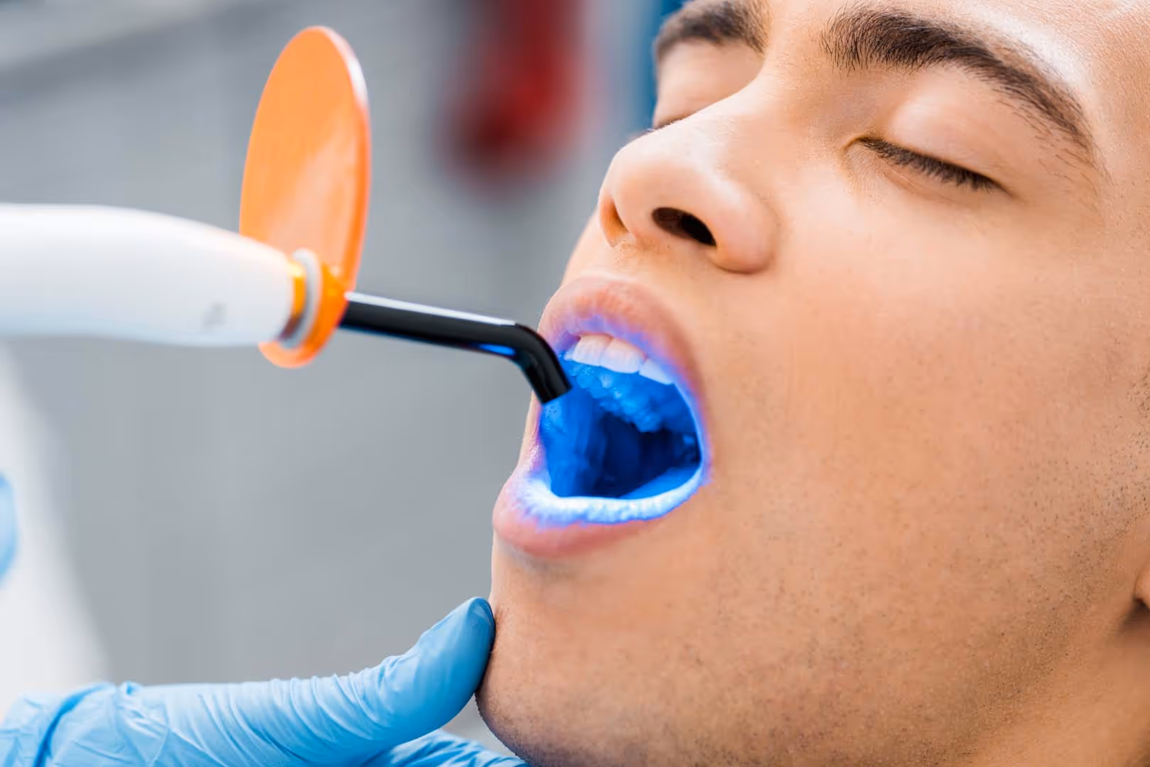 Sealants