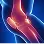 Illustration of a human knee joint with highlighted areas indicating pain or inflammation, set against a blue background.
