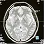 A CT scan image of a human brain showing various structures and areas in a grayscale format. The image includes visible details such as the cerebral cortex and brainstem.