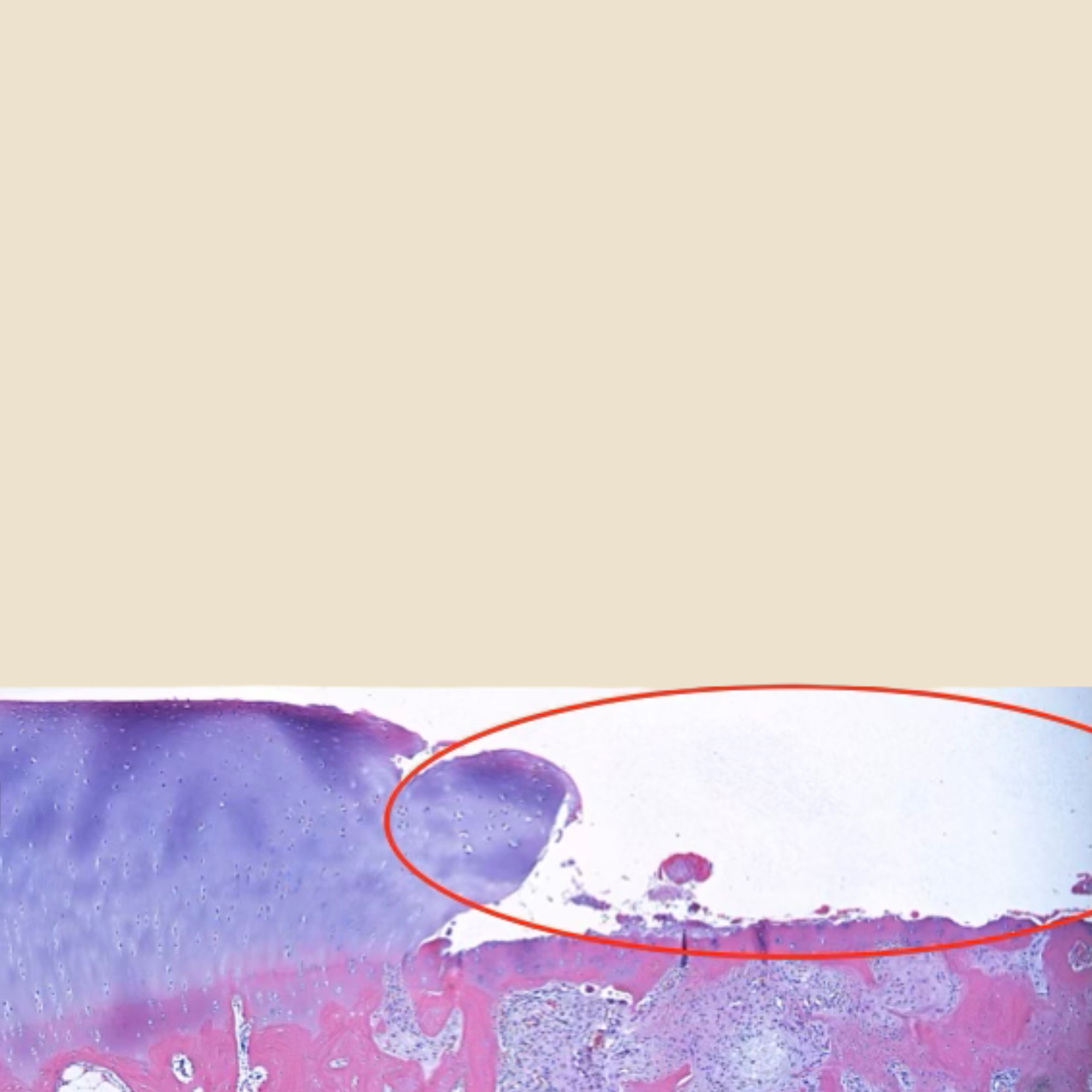 Arthroscopic view of a dog's joint on the day of treatment, showing rough, frayed cartilage